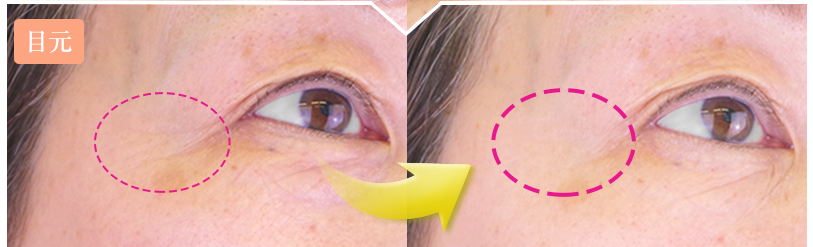 ほうれい線を化粧品で目立たなく!